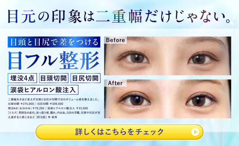 一重・奥二重の中学生が二重にする方法！自力でアイプチなしで二重になりたい中学生は必見Beauty Park Clinic