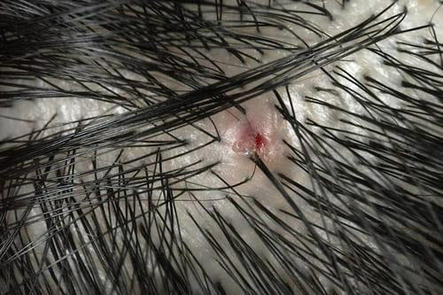 毛髪診断士監修 頭皮ニキビの原因や治し方は？かゆいときの対処法や間違えやすい病気も解説スカルプD コラムスカルプD公式サイトアンファ