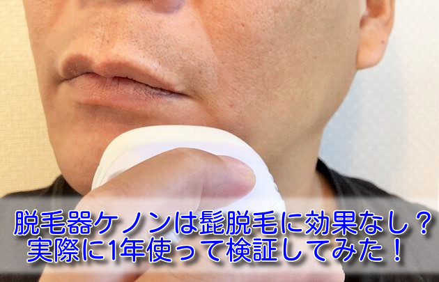 質問日時の新しい順 エステ、脱毛 回答受付中の質問 - Yahoo!知恵袋