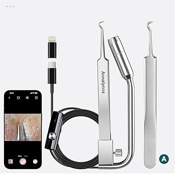 楽天市場 1080pカメラ付き脱毛ピンセット究極の精度:カメラ付きピンセット-繊細な作業に最適! - - 耳毛眉毛ピンセットの通販