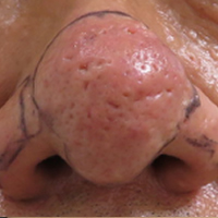 はな小岩駅前みみはなのどクリニック小岩駅の耳鼻科 アレルギー科