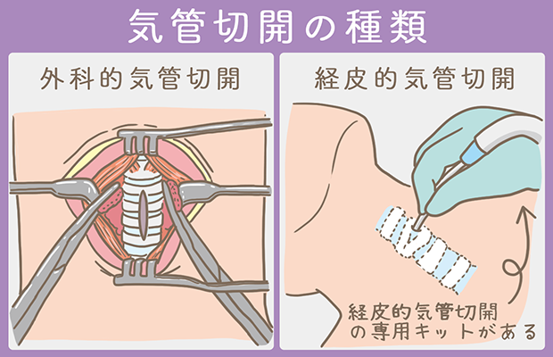 無料の気管切開イラスト素材PNG・フリー 画像 - Pngtree