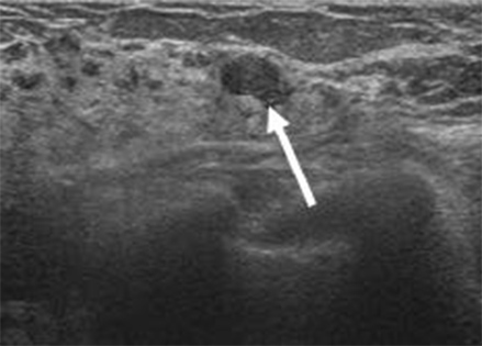 腹部エコー検査とは- 相模原 大場内科クリニック