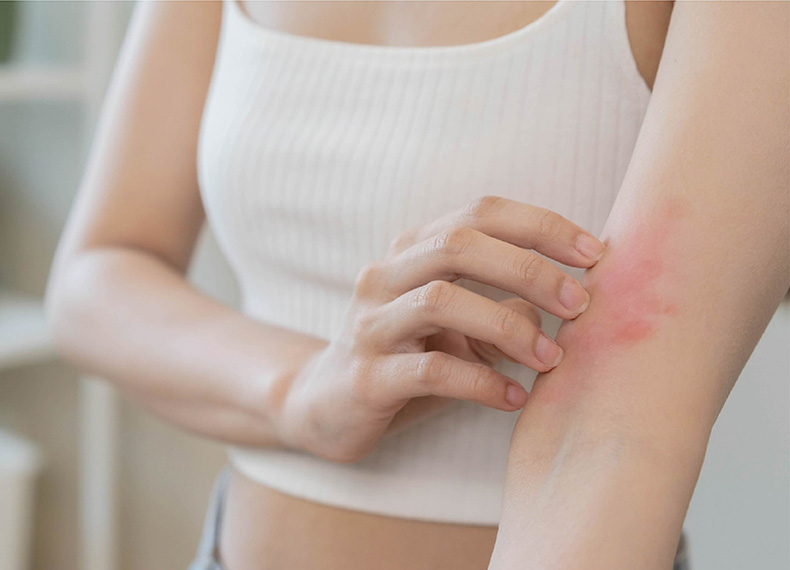 敏感肌の方は要注意！あせもの原因や見分け方、予防法を紹介肌育研究所