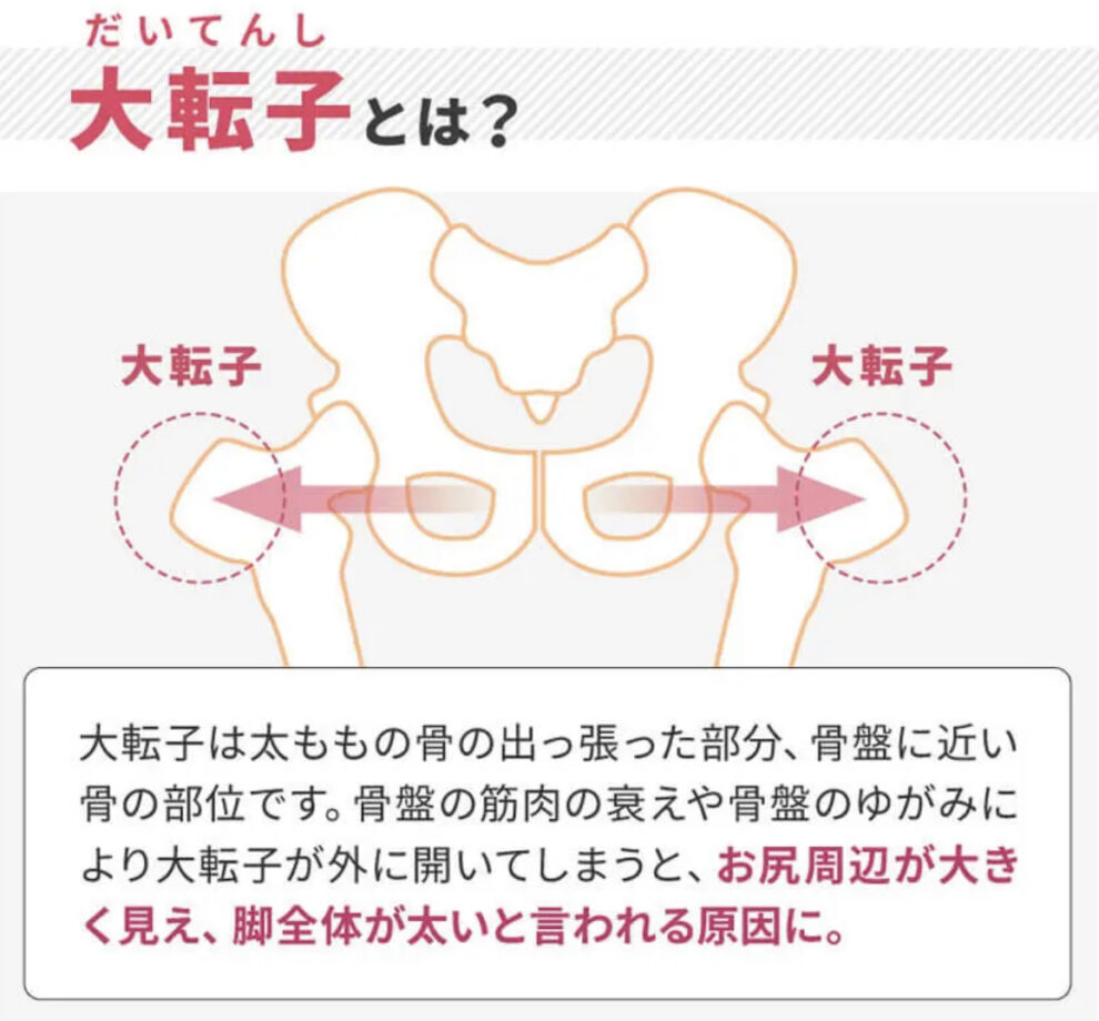 太もも裏の付け根の痛みが治らない！原因と対策について羽曳野で腰痛ヘルニアといえばメディカルケア羽曳野治療院