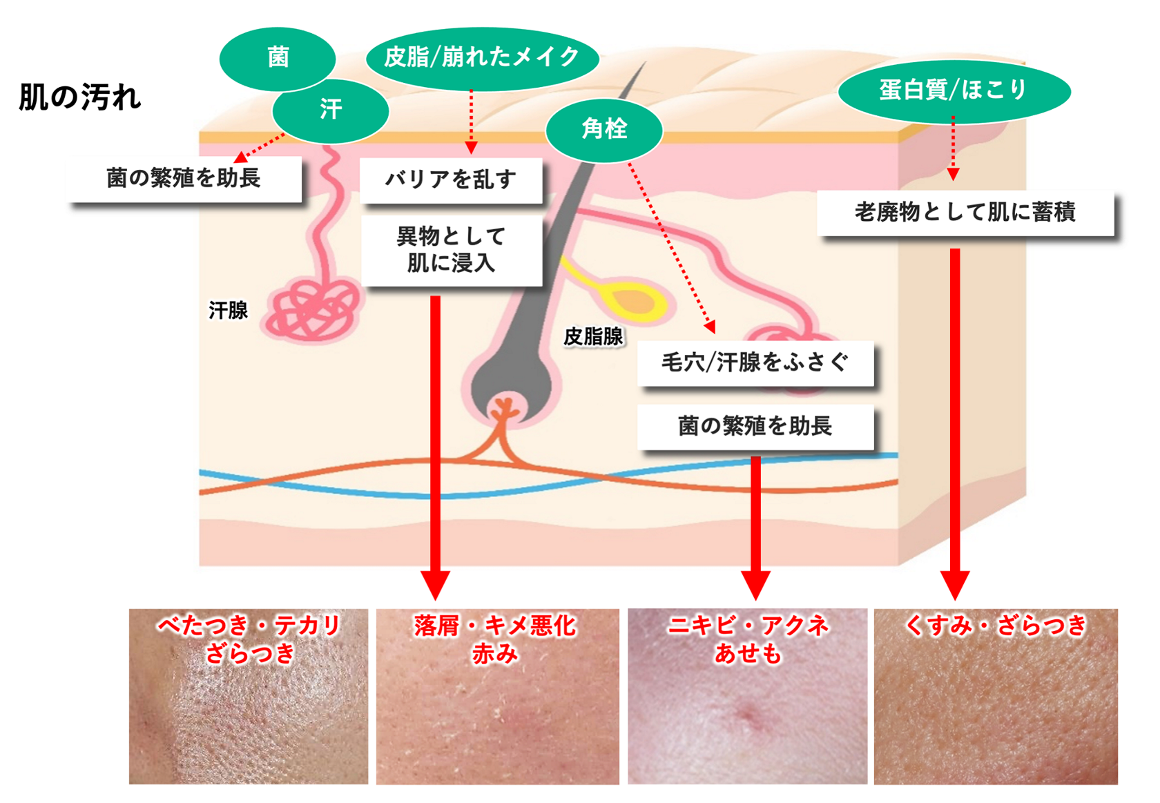 あごの角栓をなんとかしたい！原因やケア方法、注意点、実は効果的な顔脱毛についても紹介 - LACOCO COLUMN