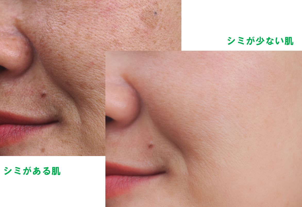 いちご鼻はホホバオイルで治せる？効果があるか43歳の毛穴で