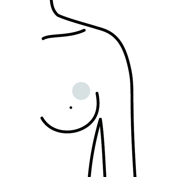 胸の痛みを引き起こす疾患足立区北千住にある乳腺クリニック、ケアリボン乳腺クリニック北千住