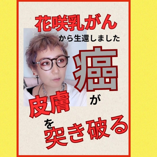 院内勉強会を行いました ～がん性皮膚潰瘍臭の治療～東大阪 かわべクリニック