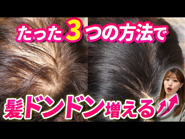 10代で髪の毛が抜ける抜け毛が多いのは病気？原因や対処法を解説吉祥寺でAGA・薄毛治療ならスーパースカルプ発毛センター吉祥寺駅前店 公式