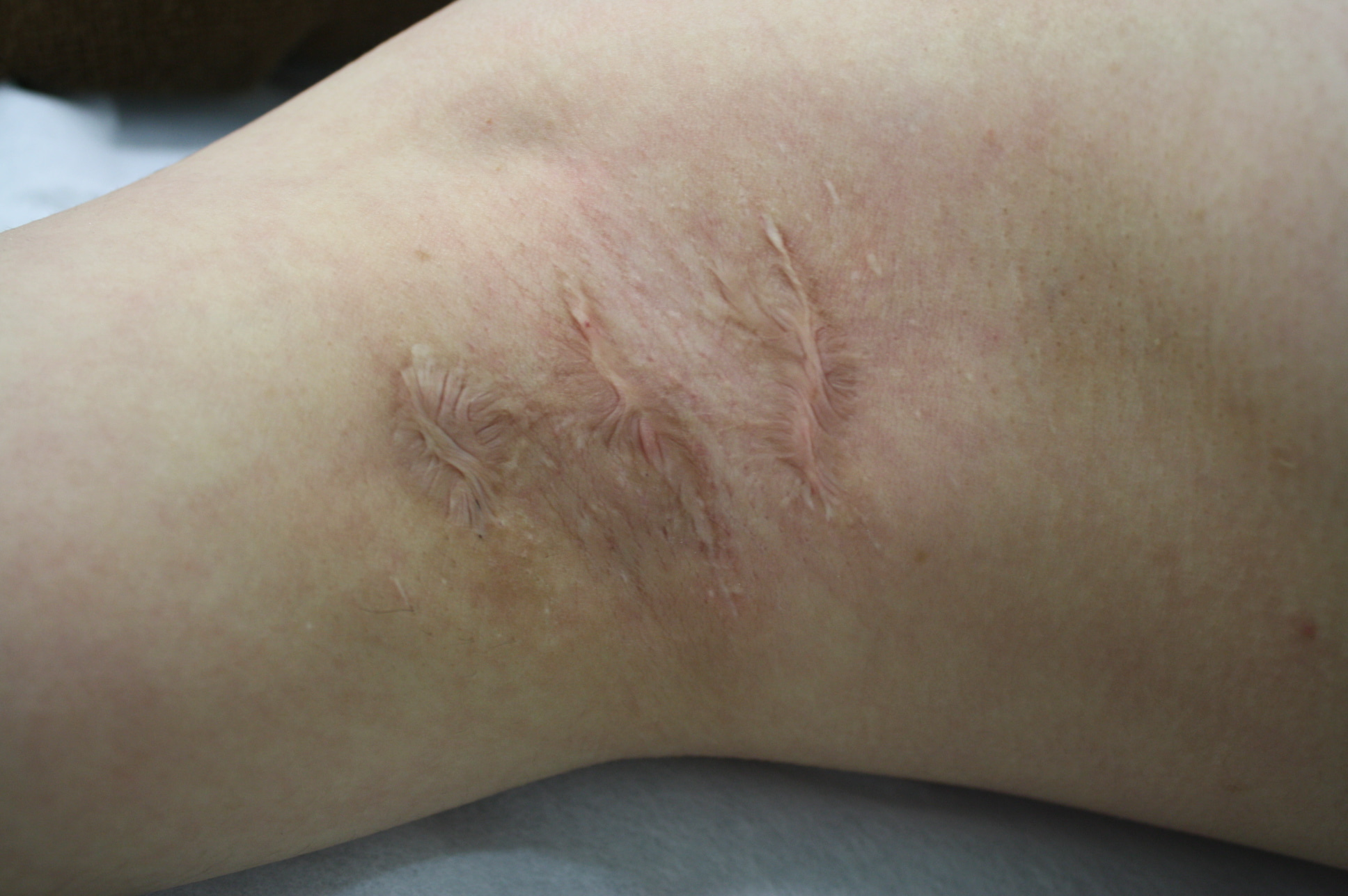 ワキガ」の原因、予防法・対処法についてロート製薬: 商品情報サイト