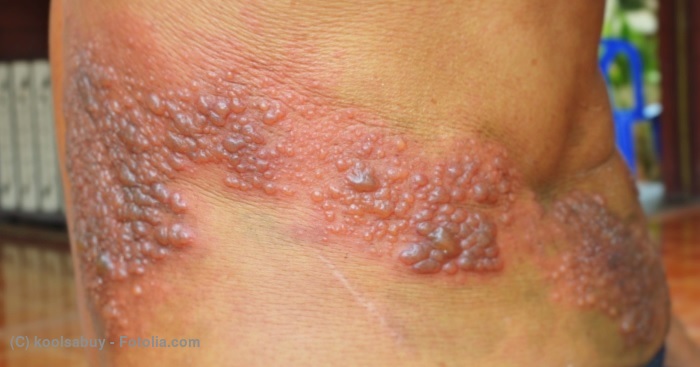 日本臨床皮膚科医会-ひふの病気