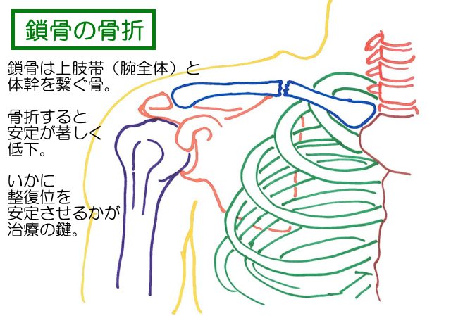 肋骨骨折 肋骨骨折って、レントゲンに写らないの？- 古東整形外科・リウマチ科