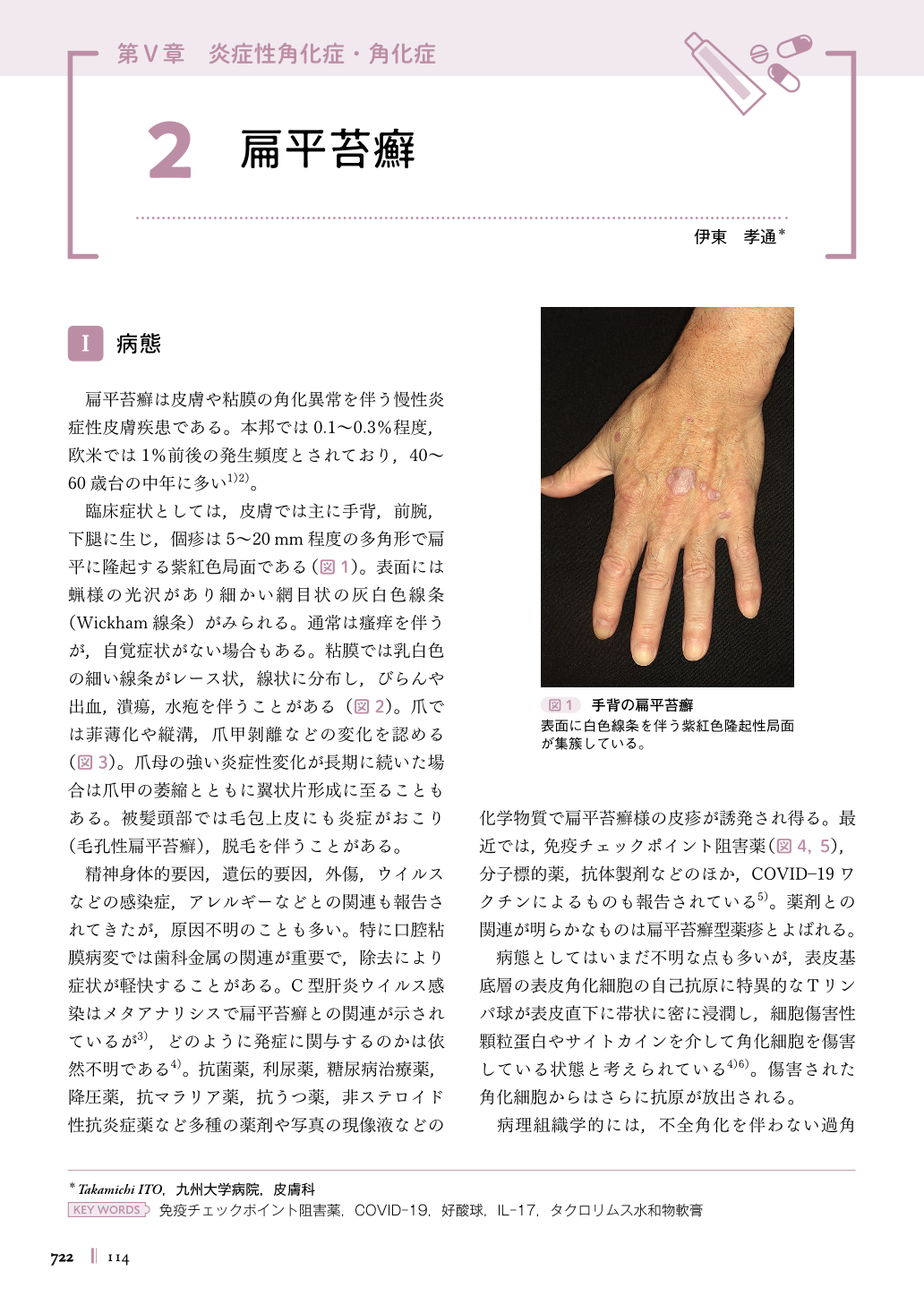 口腔扁平苔癬歯科口腔外科症例解説東京銀座シンタニ歯科口腔外科クリニック