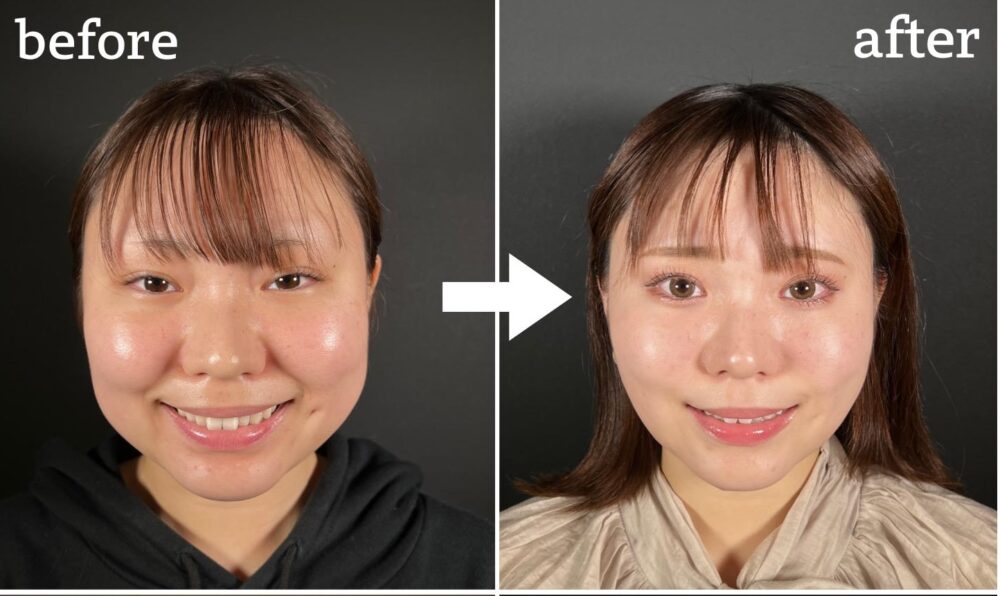 厚い頬肉を落としてシュッとさせる美容整体式セルフマッサージ