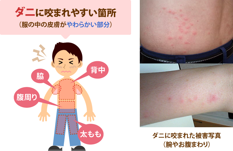 犬や猫のマダニは酢でポロリと取れる？！マダニの注意と取り方 - くらしのマーケットマガジン