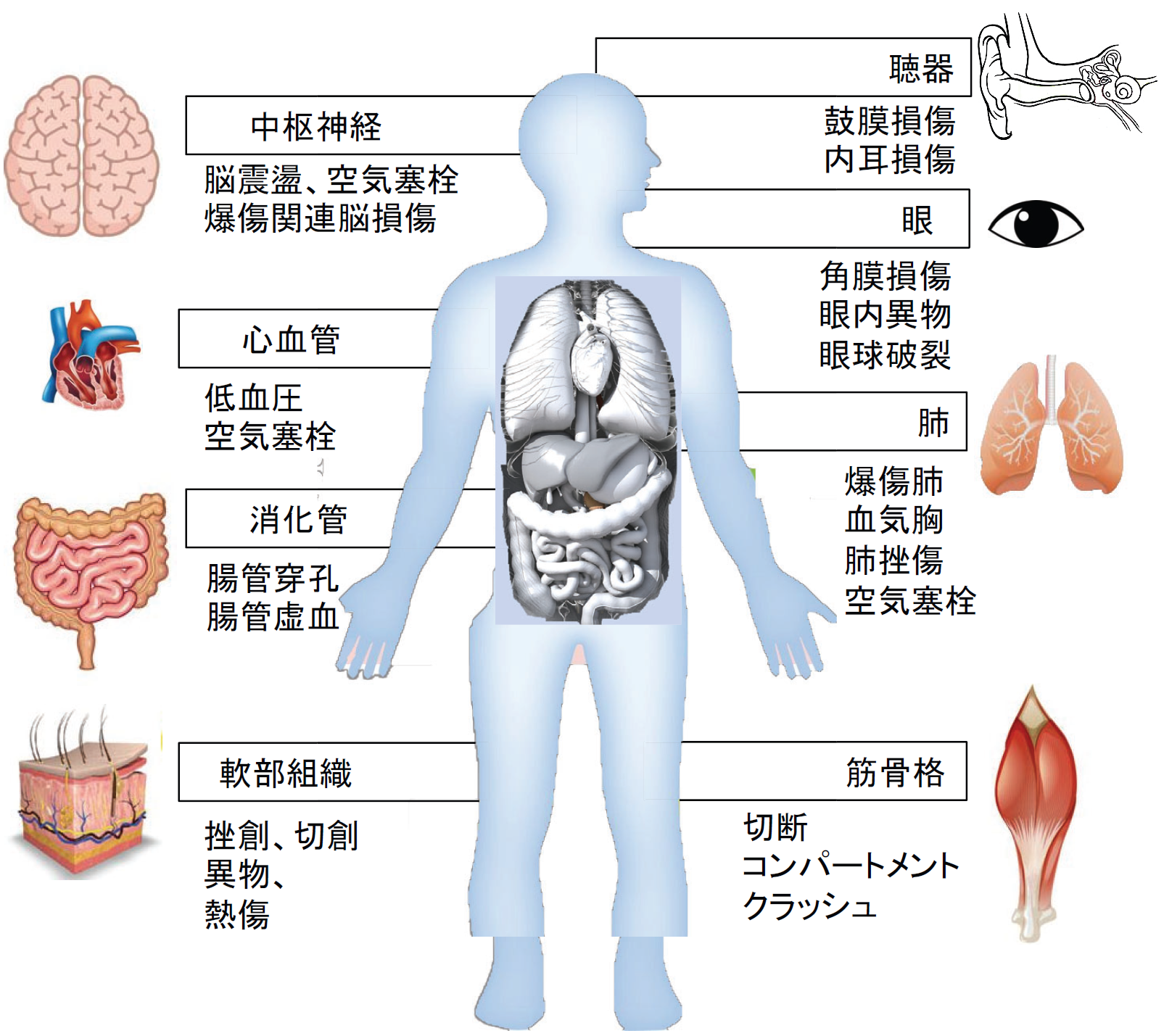 小頭症 - Wikipedia