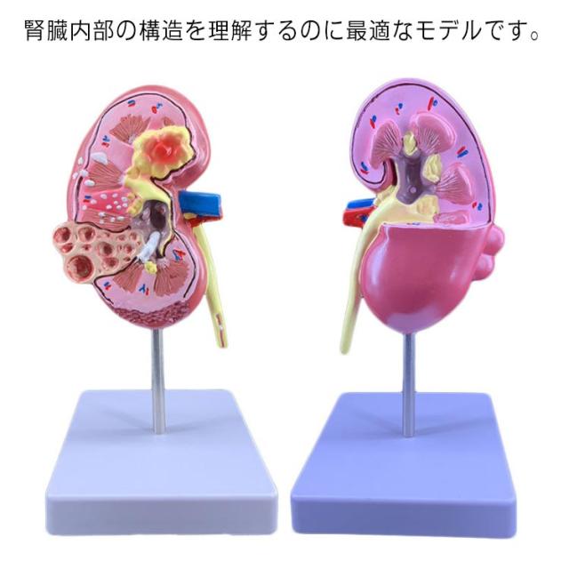 腎臓の果たす役割は排泄だけなの?腎臓の形と役割看護roo! カンゴルー