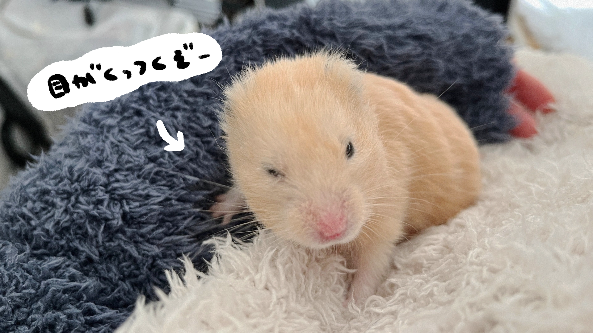 目から糸が ！ミューカスフィッシングシンドロームの治療映像