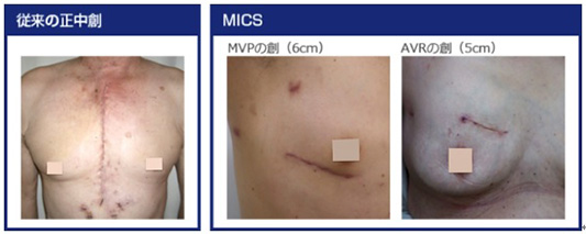 心臓血管外科NTT東日本関東病院品川区東京都