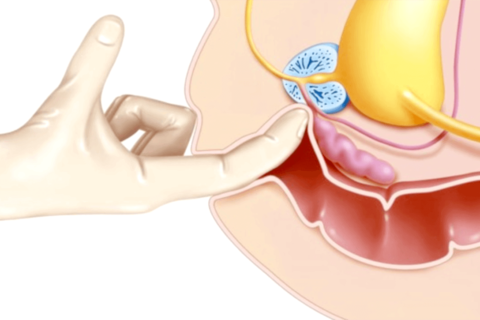 痔ろう 痔瘻 ってどんな病気？痔ろうの症状や原因についてご存知ですか？名古屋市緑区で、痛みの少ない内視鏡、肛門治療ならしもざとクリニックへ