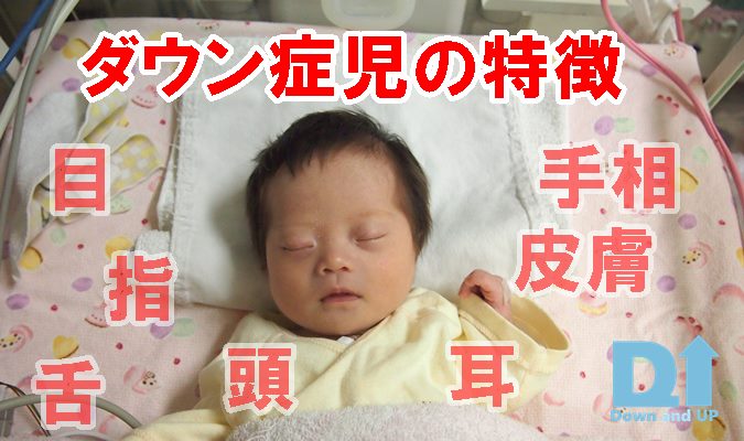 ダウン症」の5.1万点のロイヤリティフリー画像、写真素材、絵Shutterstock