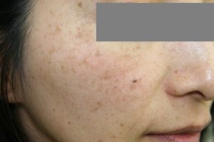 顔に点在する濃さの違うシミをメイクで隠す方法 Marisol