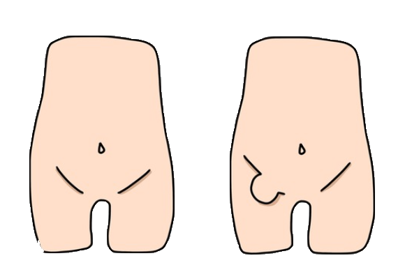 リンパ腫ペット保険のFPC