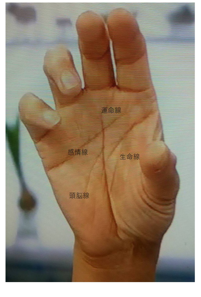 わたしは全体的に手相が薄い気がします。両手ともますかけ線があります。ますかけ- Yahoo!知恵袋