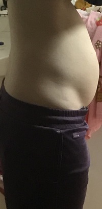 専門医が解説 腹部のはり・もたれ・違和感の原因と治療巣鴨駅前胃腸内科クリニック