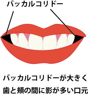 ニコッ」と笑ったときに口角が左右非対称になる原因と予防の仕方Hanone ハノネ ～毎日キレイ 歯の本音メディア～