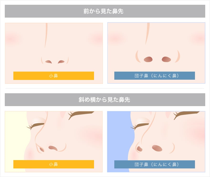 永野芽郁の鼻の噂を全部集めてみた！にんにくってww可愛いのに