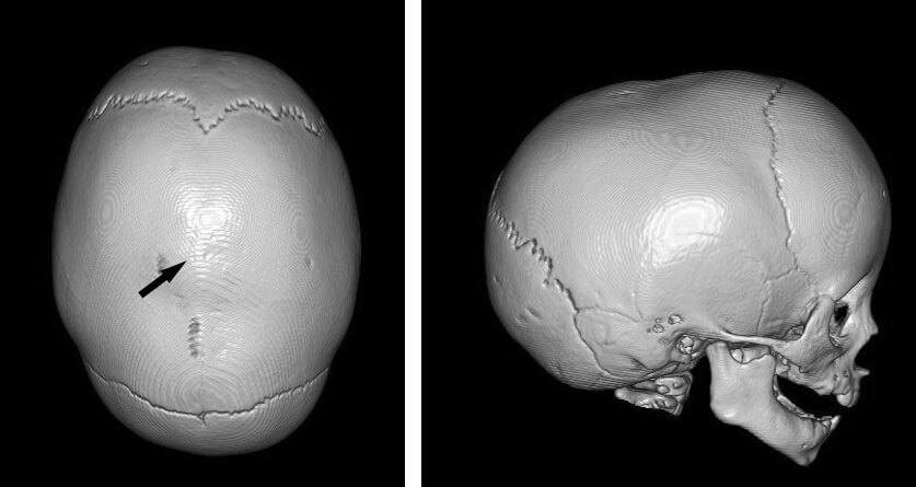 加齢による骨格の変化を知ろう kaw_メンズ理論 男性の髪で悩める全ての人に
