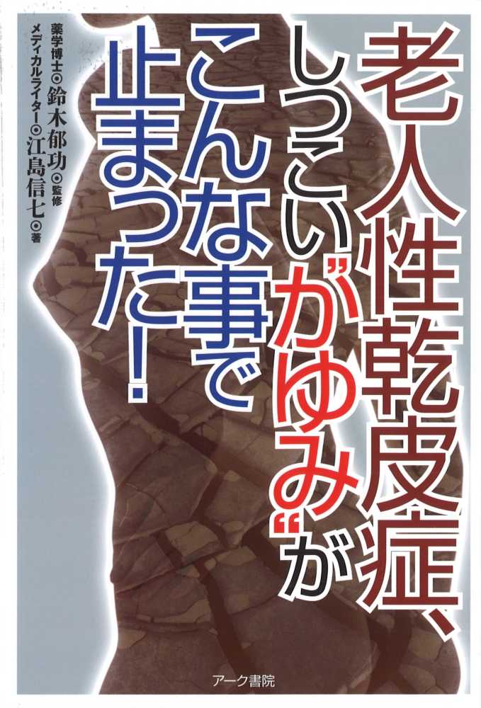 老人性乾皮症②：その原因 – ビオデルマ公式サイト