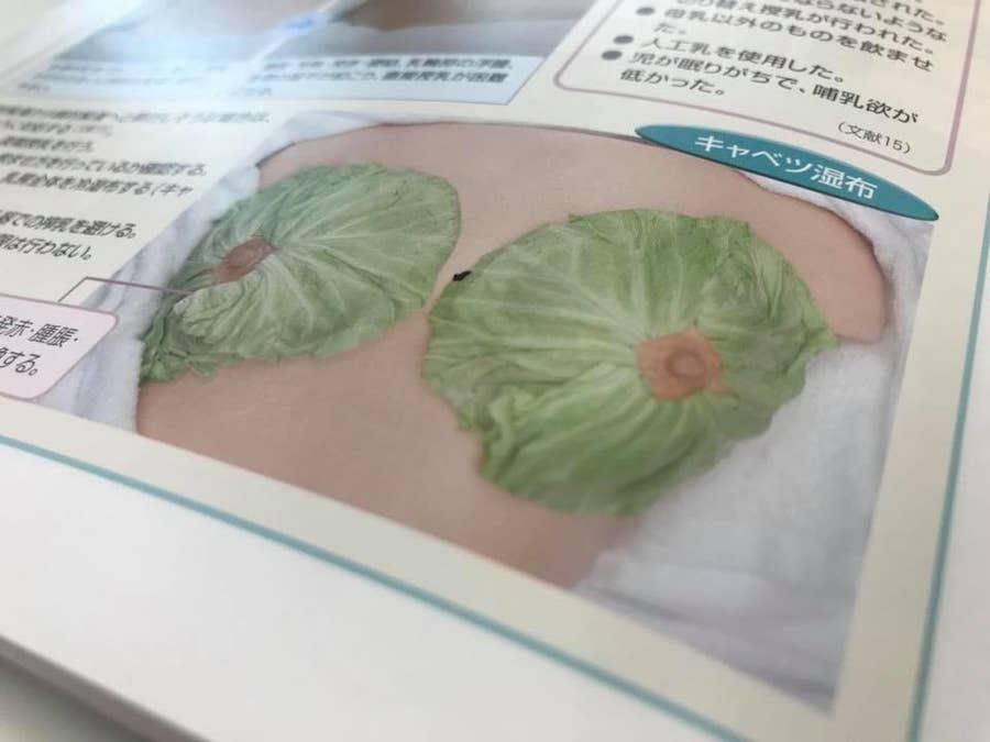 慢性乳腺炎– 神門鍼灸整骨院本院