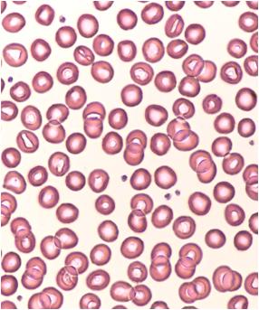血液のはたらきー血漿成分・血球成分