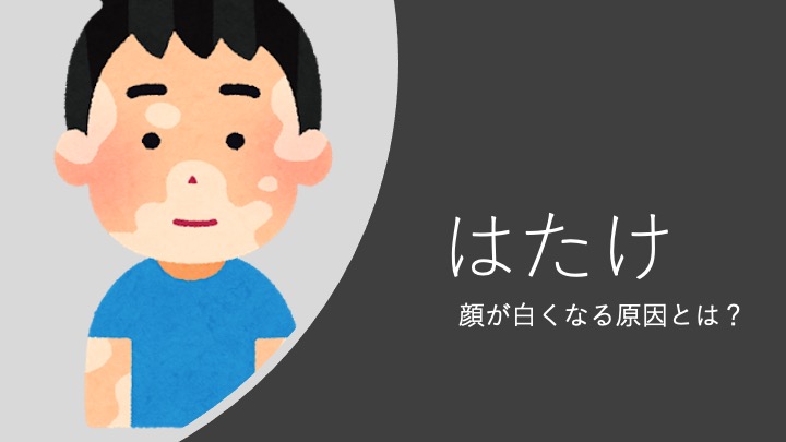 脂漏性皮膚炎高知市のおすすめ皮膚科なら“ふみの皮フ科”ニキビ・シミ取り・医療脱毛