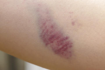 あざまつもと皮膚科クリニック福知山・丹波・丹波篠山市の皮膚科・美容皮膚科