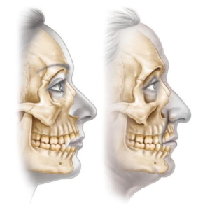ヒアルロン酸注射 大阪医療機関のヒアルロン酸注射「つかはらクリニック」