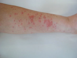 刺す毛虫３ イラガ 庭の刺す毛虫・刺さない毛虫 -- 公益社団法人農林水産・食品産業技術振興協会