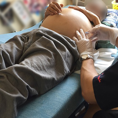 腹水抜きます27歳癌闘病日記