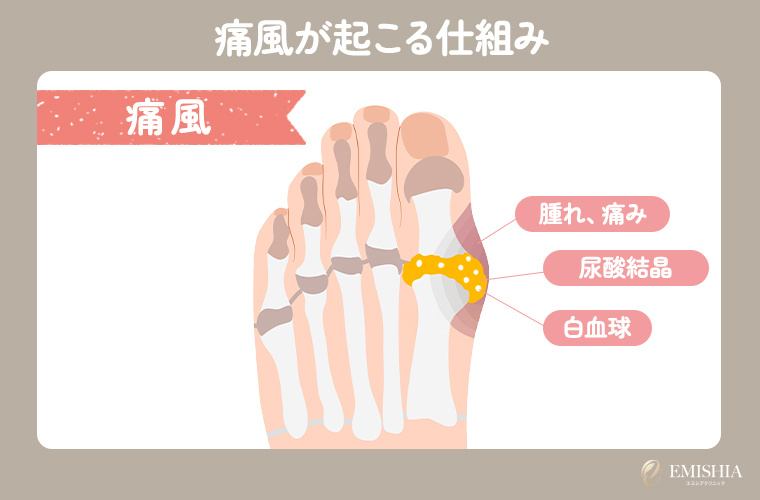 楽天市場 かかと痛い 痛風の通販