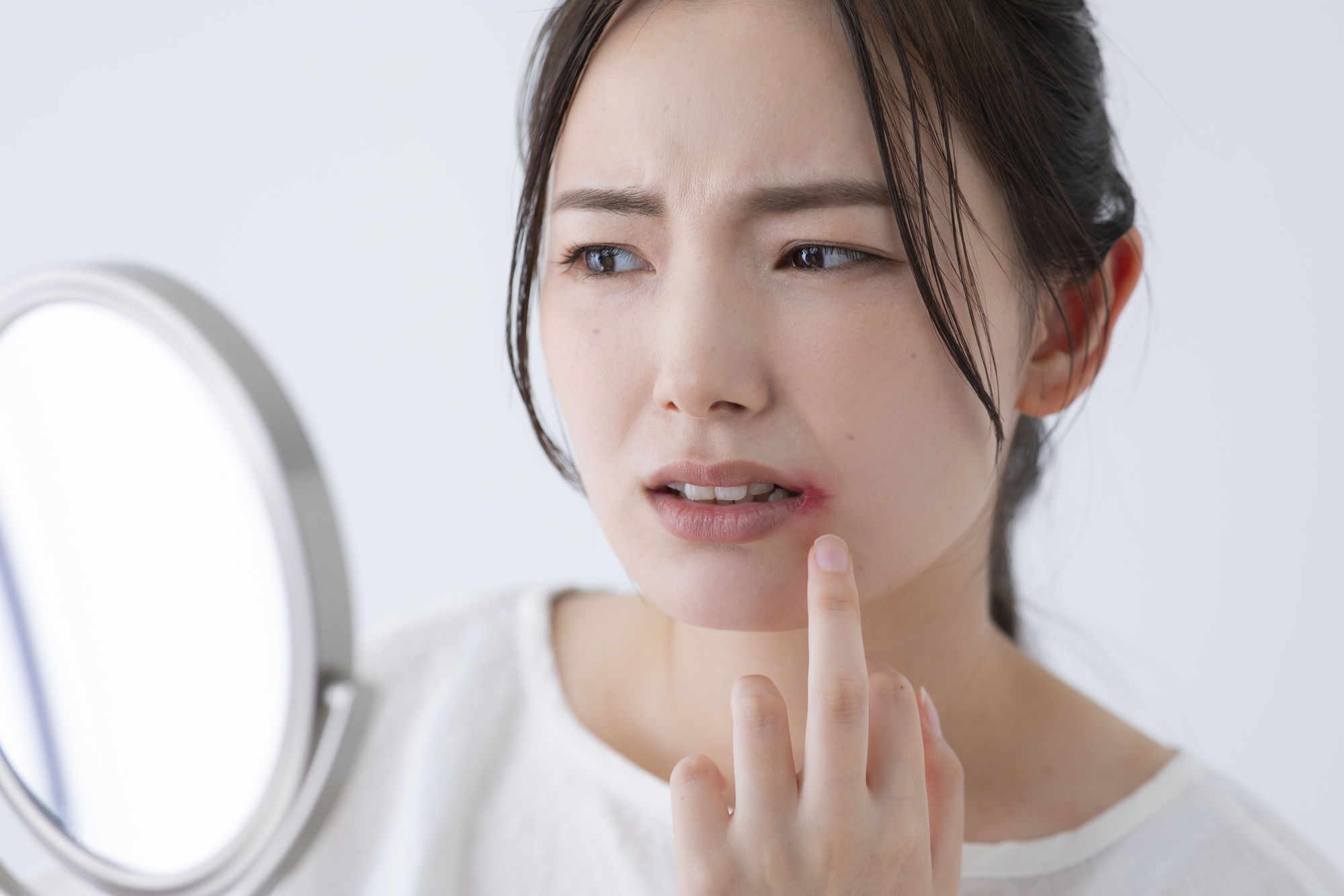 医師監修・作成 口唇ヘルペスとはどのような病気か：原因、症状、治療などMEDLEY メドレー