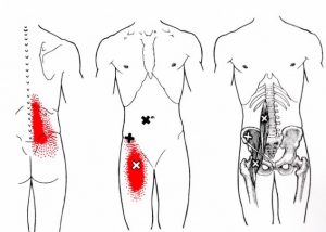 トリガーポイント整体とは荻窪きりん堂整骨院 整体院