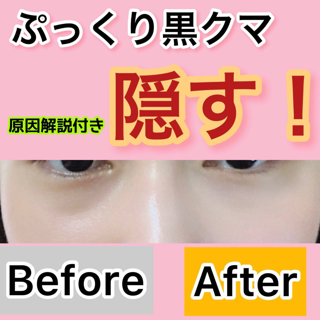 クマ隠しコンシーラーのおすすめ10選黒クマ向けやドラッグストアで買えるプチプラもランク王