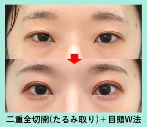 アーモンドアイがメニューになりましたきらきらクリニック Dr.さくらのブログ