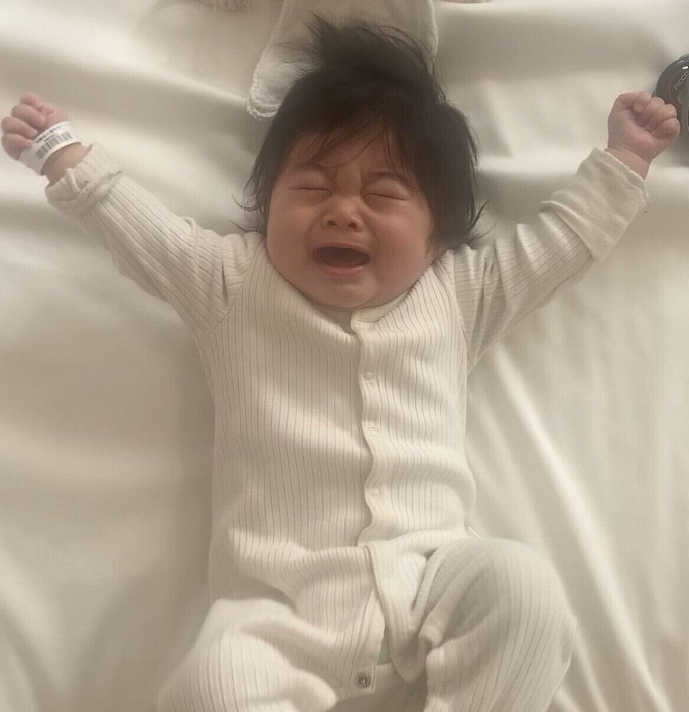 モロ反射 - Wikipedia