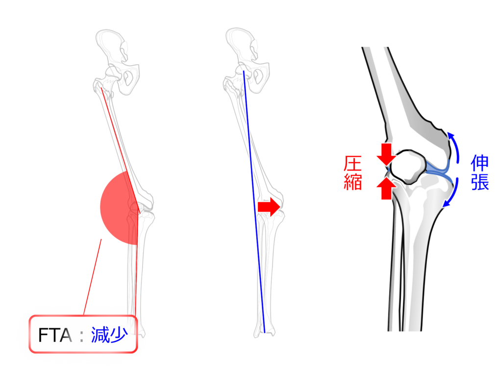 内反膝 O脚 とは？原因と治し方をシンプルに解説 - 株式会社リハサク