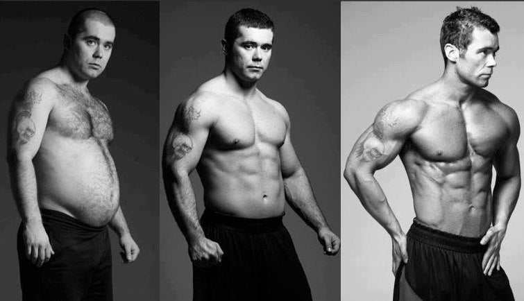 医師監修 ～脂肪吸引：体脂肪の特性～東京美容外科