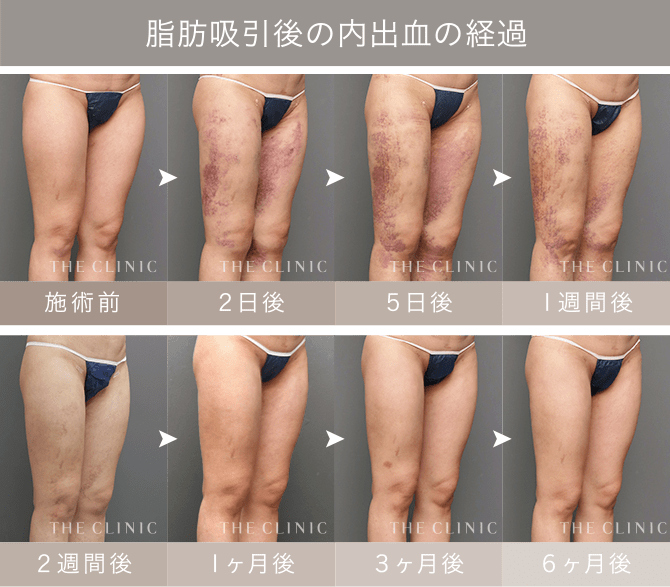 太ももの痛い原因を部位別に解説！医師が監修